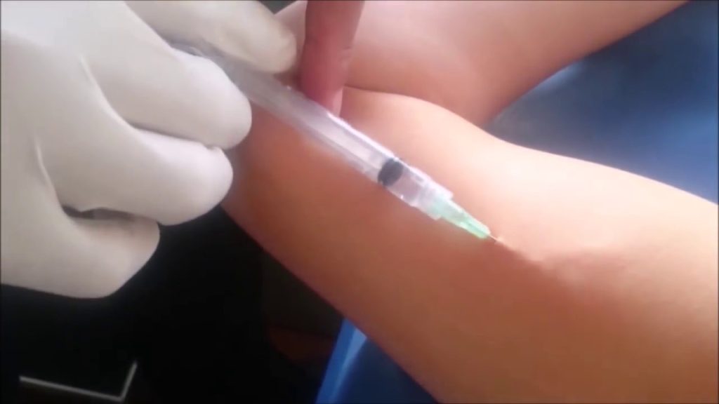 Harán en Clodomira un operativo de implantes subdérmicos anticonceptivos para adolescentes Harán en Clodomira un operativo de implantes subdérmicos anticonceptivos para adolescentes